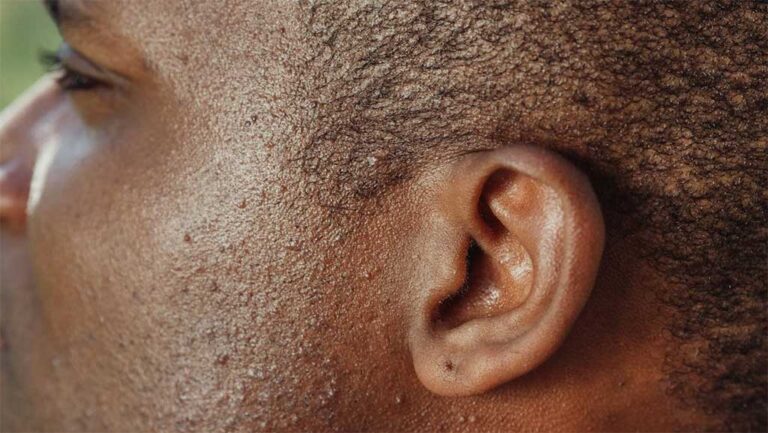 Think You Might Be Struggling With Hearing Loss? Here's What To Do